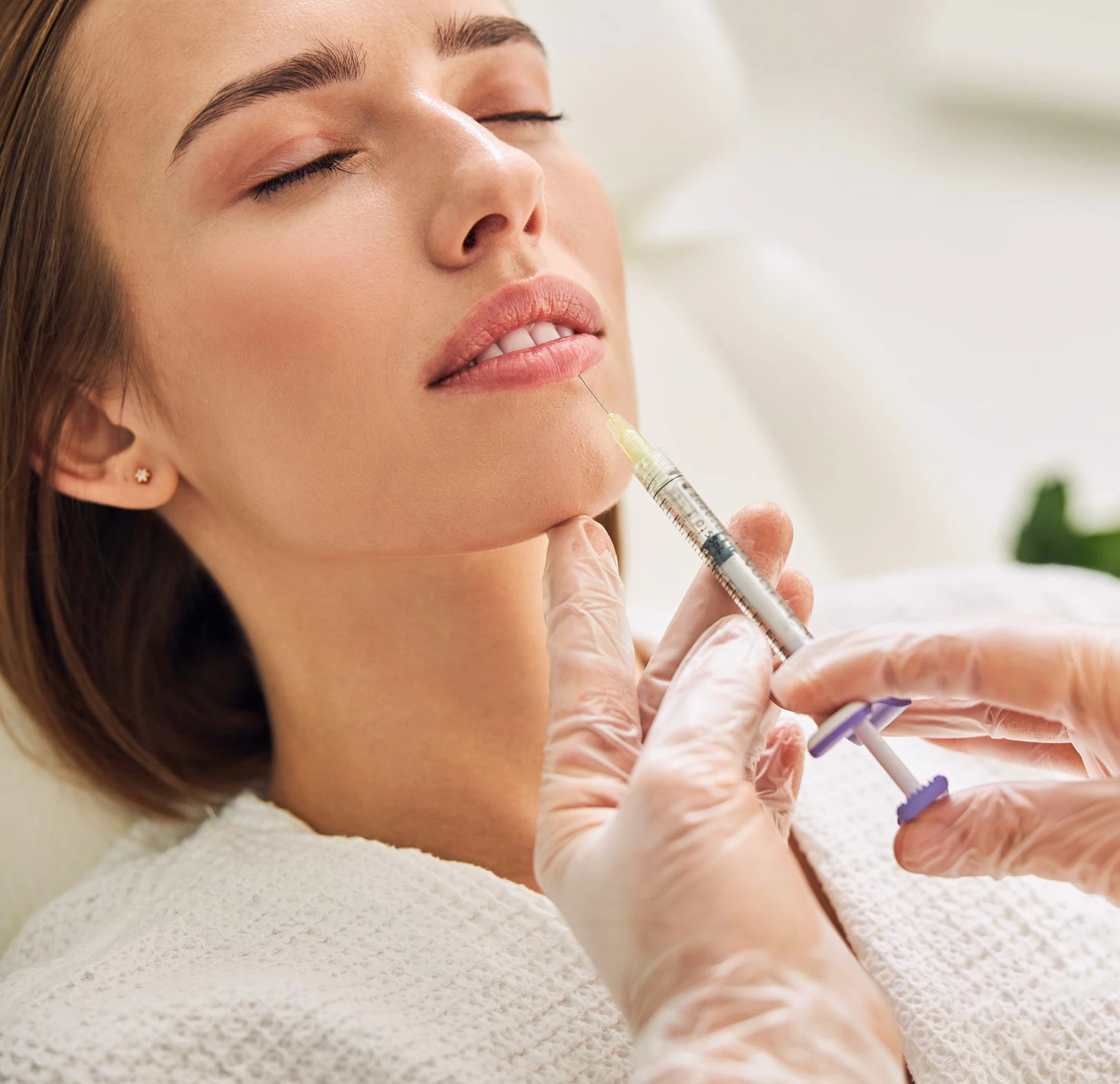 dermal-fillers